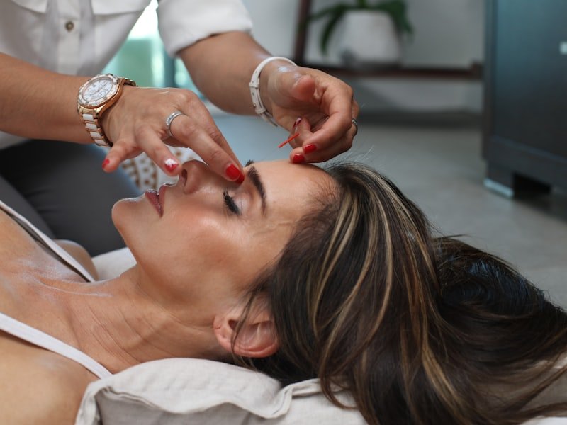Patient receiving facial acupuncture with single-use sterile needles